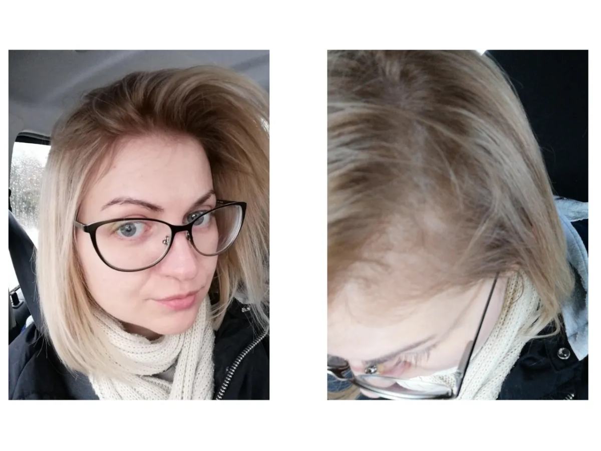 Jak wybrać farbę do ciemnego odrostu przy blondzie i uniknąć kontrastu